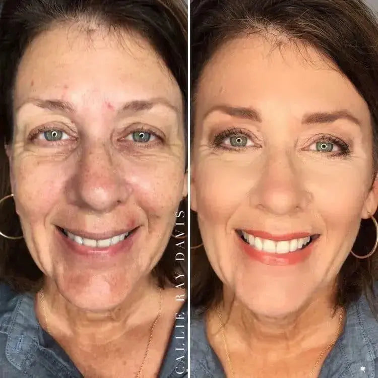 Ageless Skin Kit
