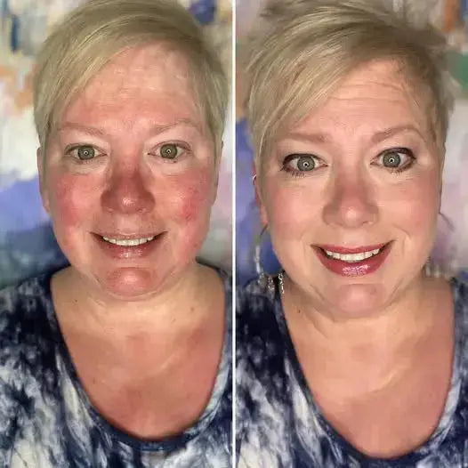 Ageless Skin Kit